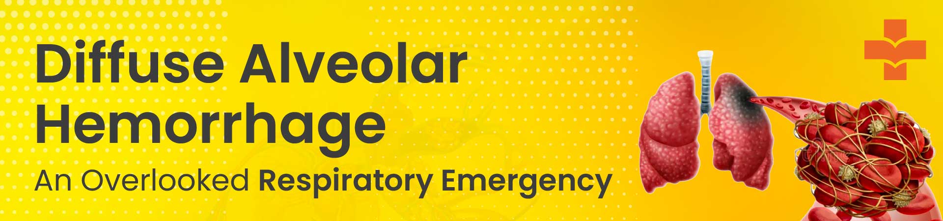 Diffuse Alveolar Hemorrhage Emergency