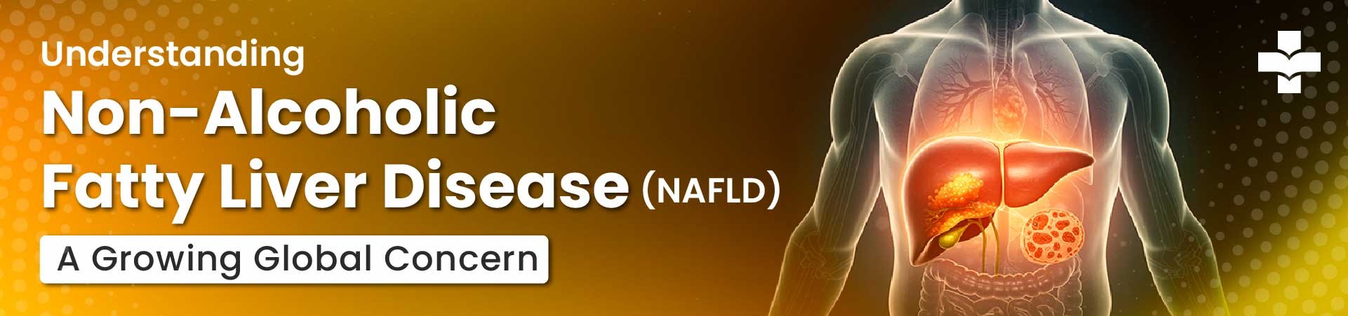 NAFLD overview and rising global concern.