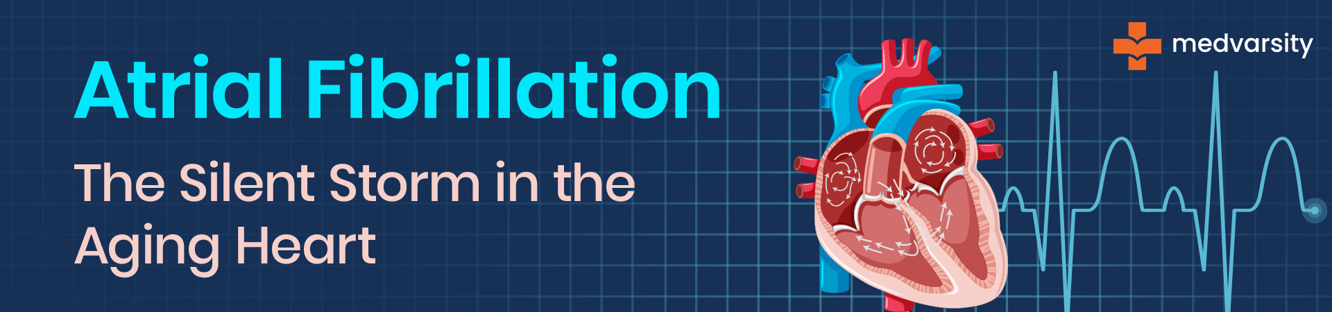 Visual representation of atrial fibrillation in the elderly heart